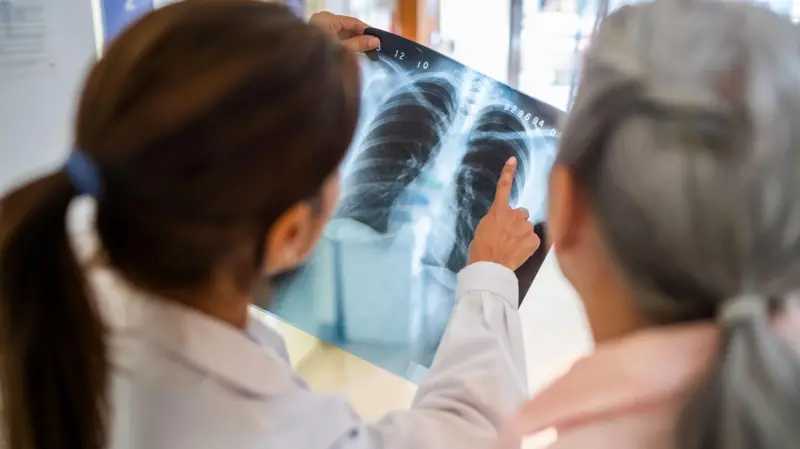 Cómo saber la edad real de tus pulmones