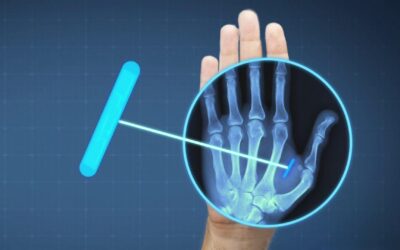 Suecia implementa microchip bajo la piel: ¿cuál es su función?
