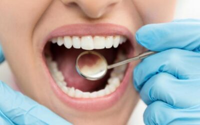 Jornada gratuita de extracciones dentales llega a Spartanburg