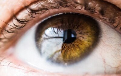 Sarampión: la amenaza para la visión de los niños