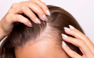 Cuero cabelludo limpio y sedoso: trucos caseros para lograrlo