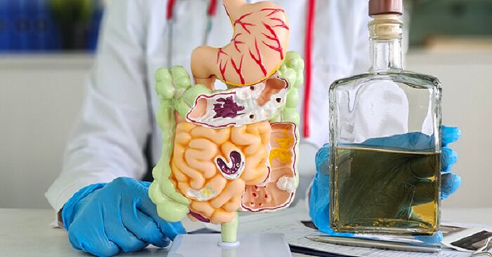 Síndrome de autofermentación: ¿cómo el intestino produce alcohol?