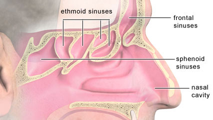  sinusitis