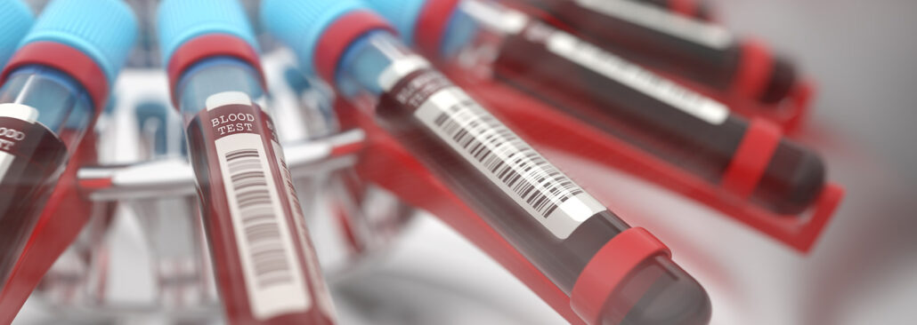  análisis de sangre 