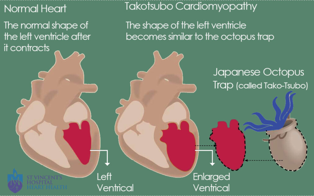corazón roto 
