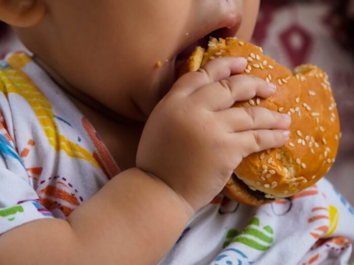  obesidad 