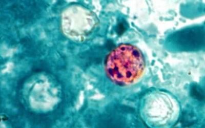 Cyclospora: cómo evitar infecciones intestinales graves