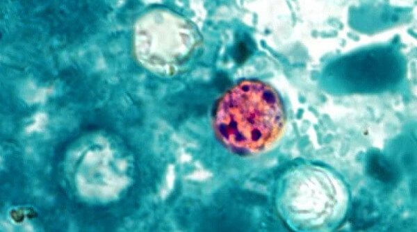 Cyclospora