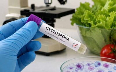Carolina del Sur confirma 30 casos de ciclosporiasis: autoridades en alerta