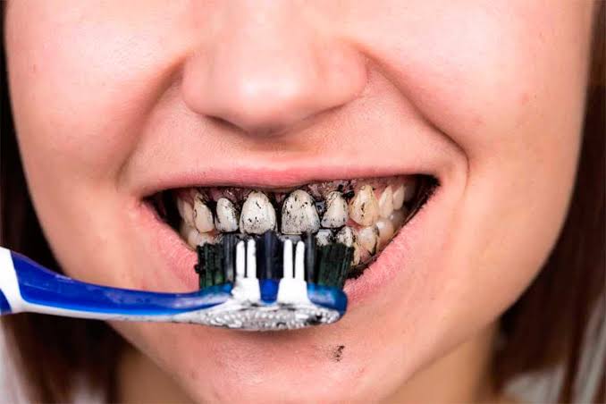 Vivian Menéndez dientes