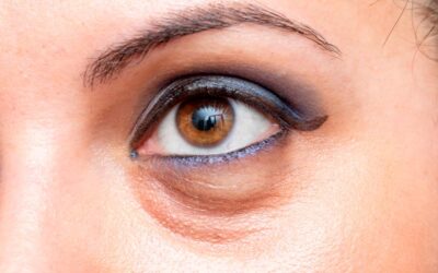 Trucos prácticos para reducir las ojeras y lucir un rostro más fresco