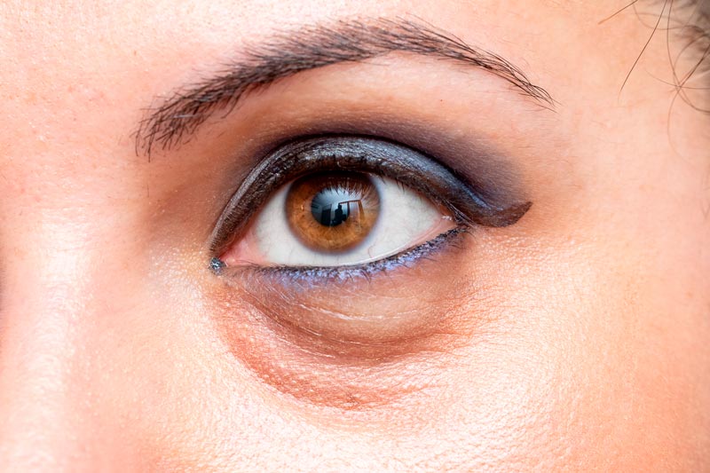 Trucos prácticos para reducir las ojeras y lucir un rostro más fresco