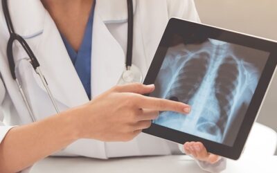 Adenocarcinoma: todo sobre el cáncer que enfrenta el papa León XIV