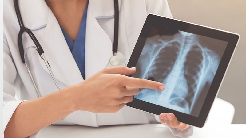 Adenocarcinoma: todo sobre el cáncer que enfrenta el papa León XIV